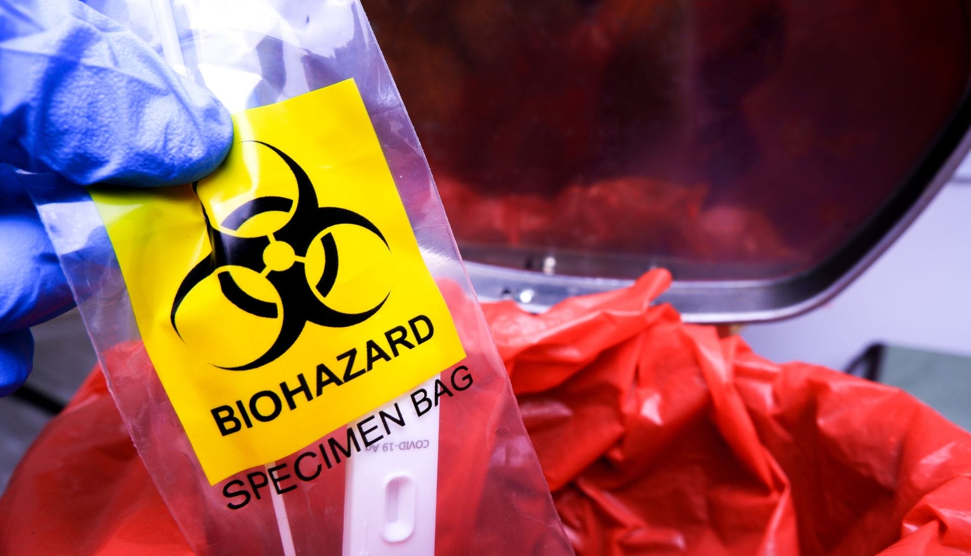 Biohazard Waste Disposal Methods